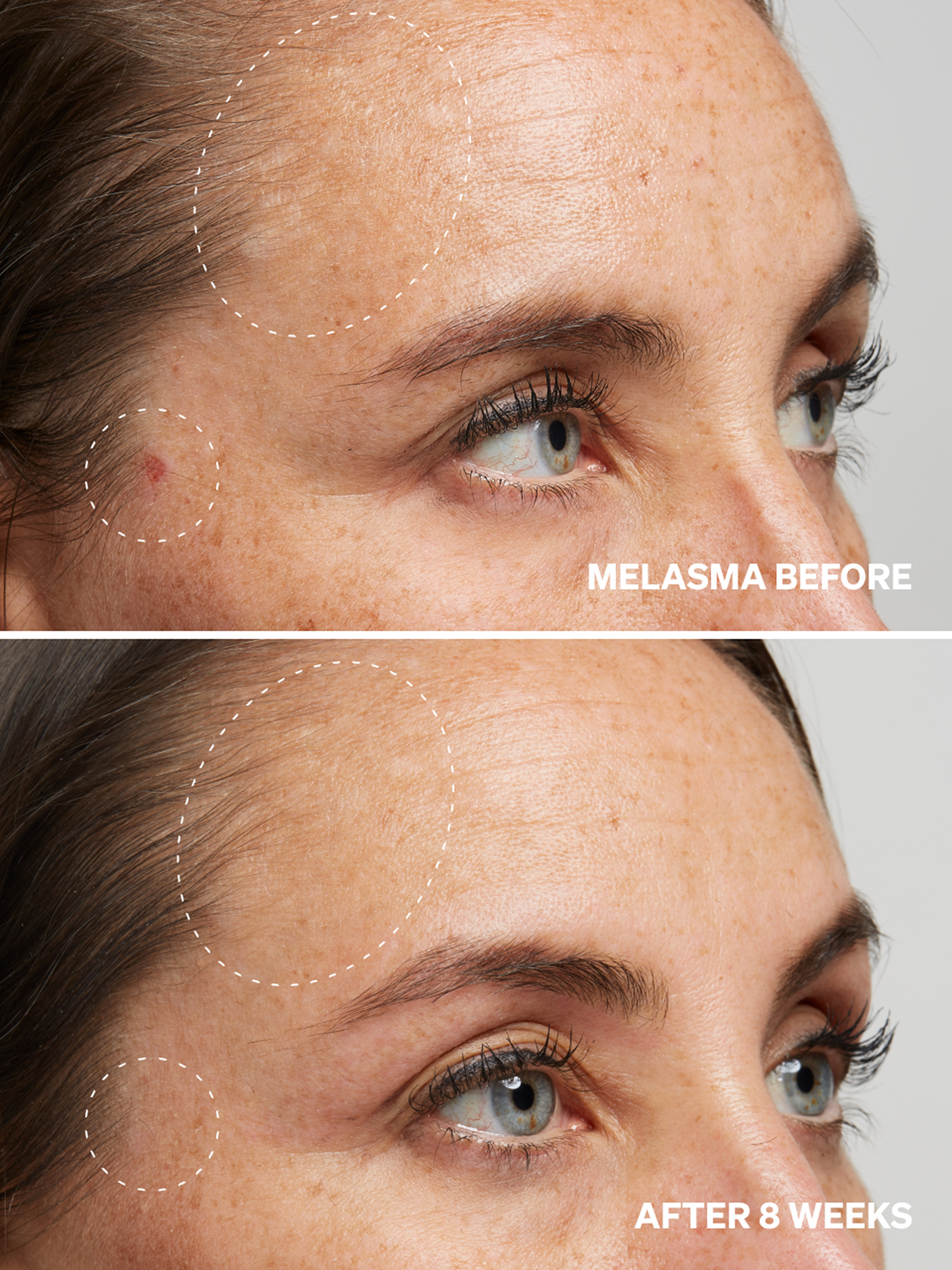 Alpha Arbutin 2% NEW