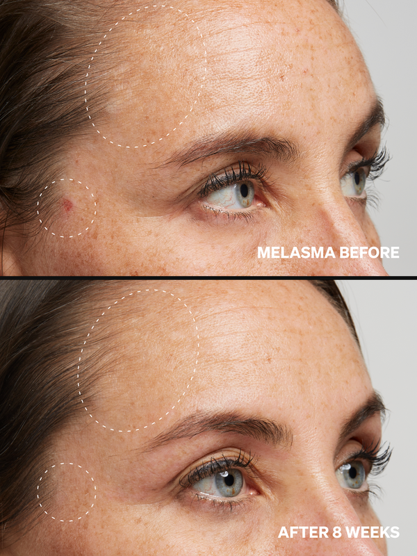 Alpha Arbutin 2% - Onélogy