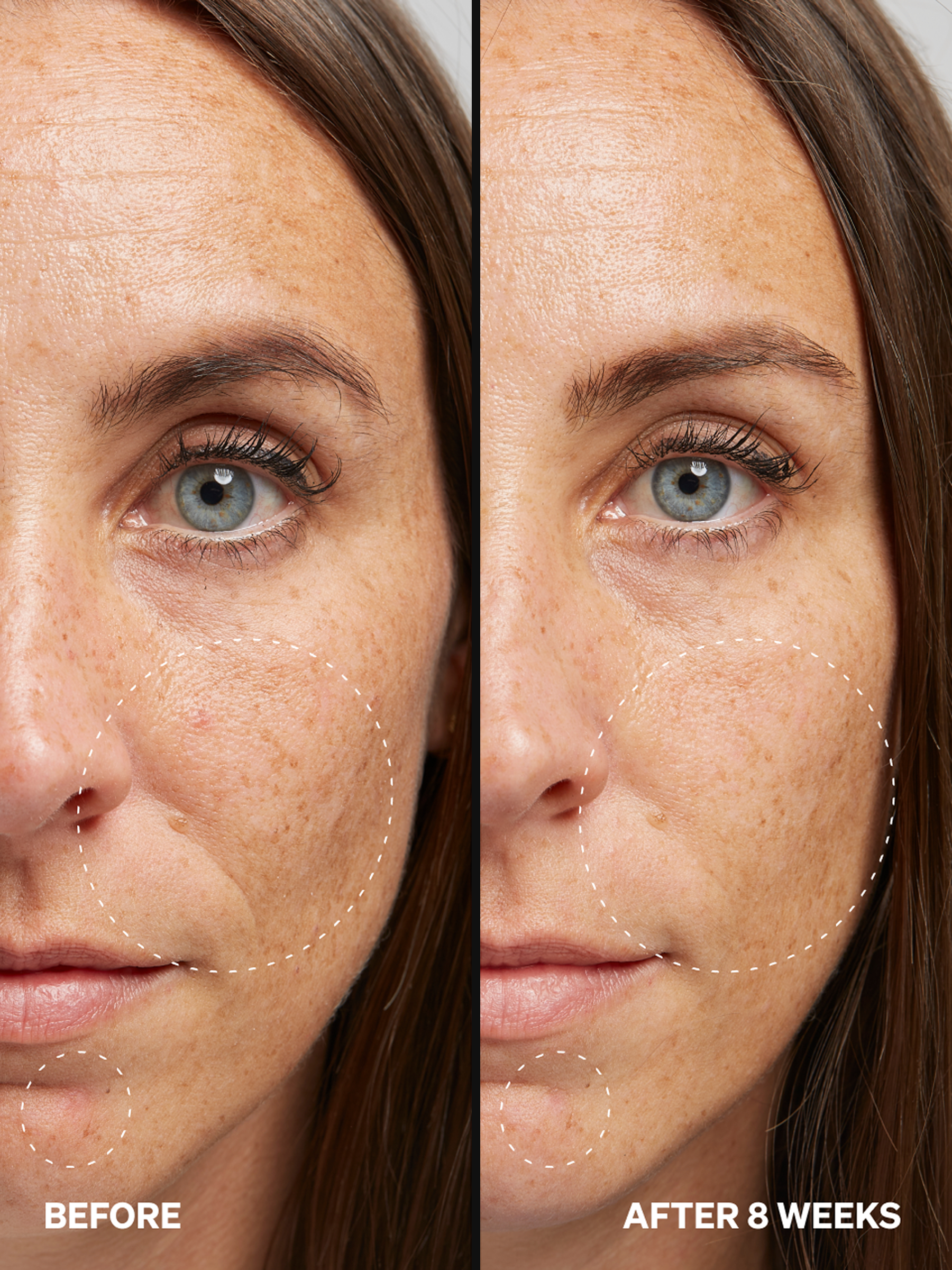 Alpha Arbutin 2% - Onélogy