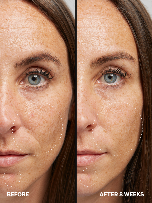 Alpha Arbutin 2% - Onélogy