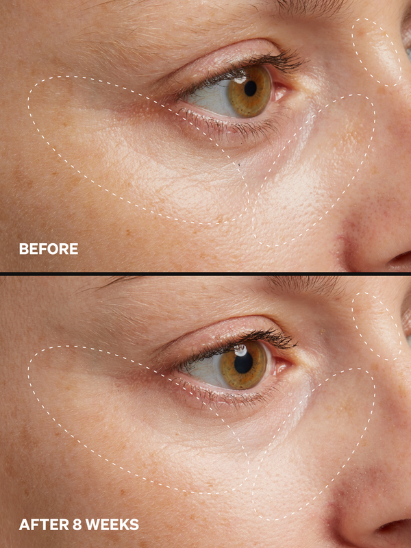 HPR Retinoid 0.3% - Onélogy