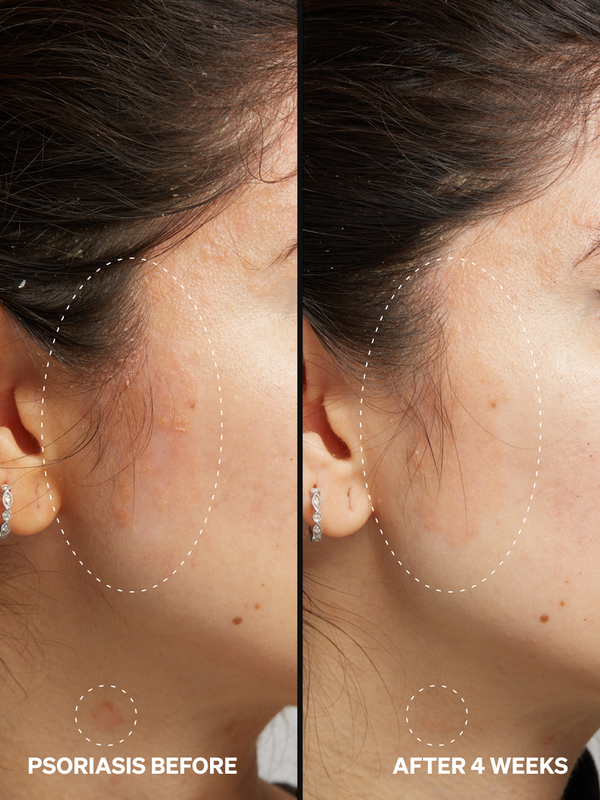 Niacinamide 2% - Onélogy