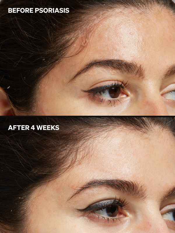 Niacinamide 2% - Onélogy