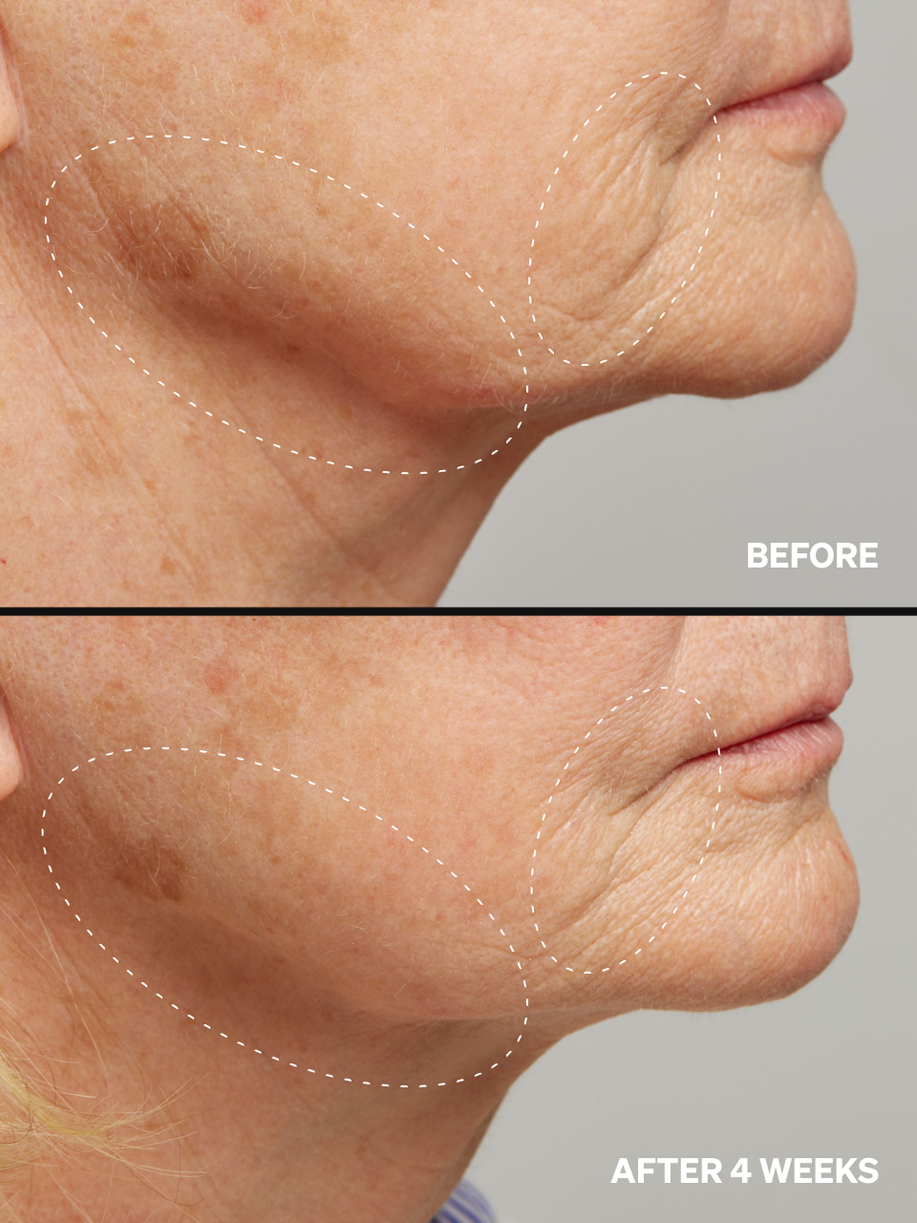 Peptides-Cu 0.6% - Onélogy